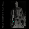Rema Rema - Fond Reflections (2LP)
