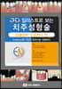 3D 일러스트로 보는 치주성형술
