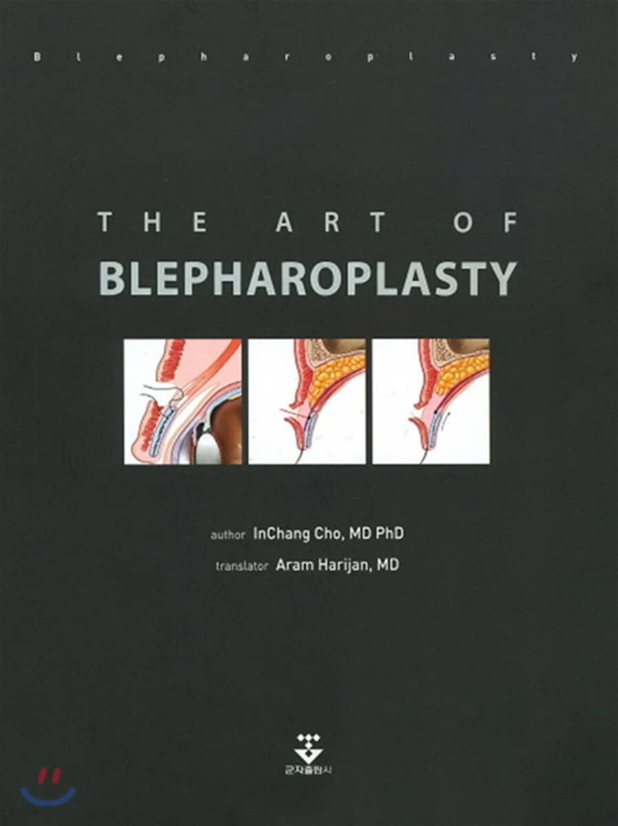 The Art of Blepharoplasty