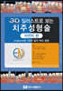 3D 일러스트로 보는 치주성형술 자연치 편