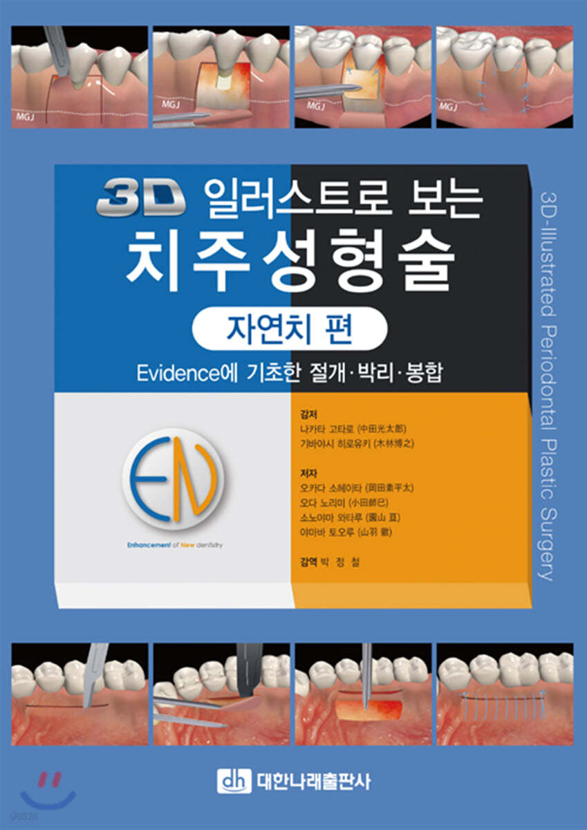 3D 일러스트로 보는 치주성형술 자연치 편