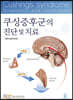 쿠싱증후군의 진단 및 치료
