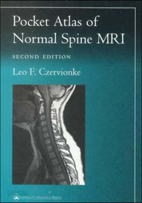 Pocket Atlas of Spinal MRI