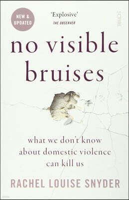 No Visible Bruises