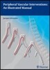 Peripheral Vascular Interventions: An Illustrated Manual
