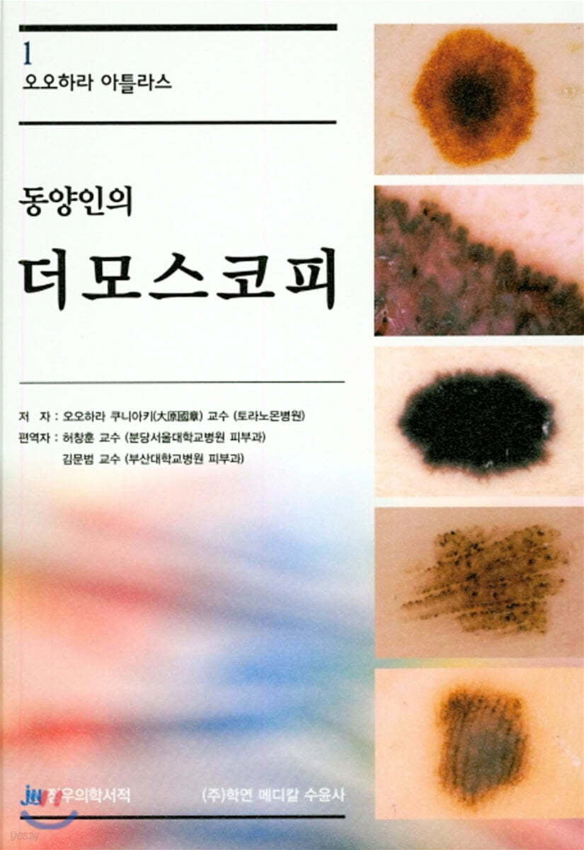 동양인의 더모스코피