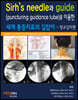 Sirh's needle과 guide(puncturing guidance tube)를 이용한 세계 통증치료의 길잡이