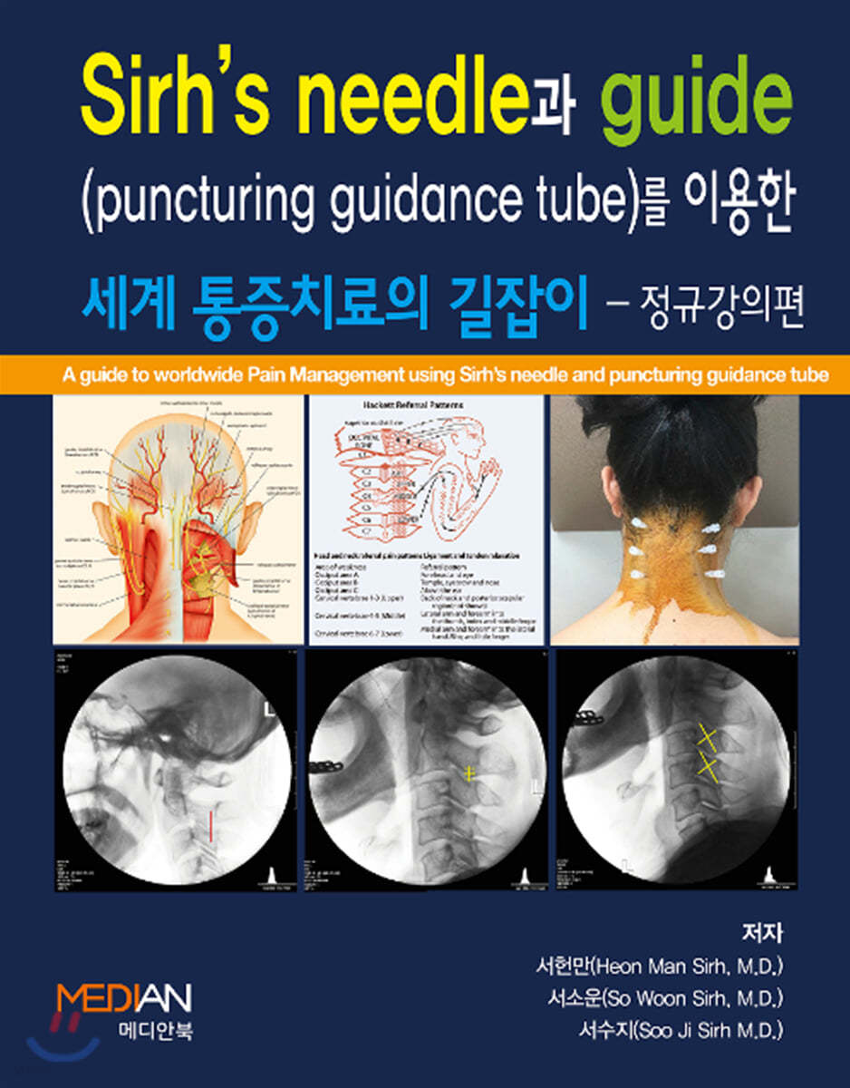 Sirh&#39;s needle과 guide(puncturing guidance tube)를 이용한 세계 통증치료의 길잡이