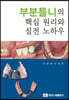 부분틀니의 핵심 원리와 실전 노하우