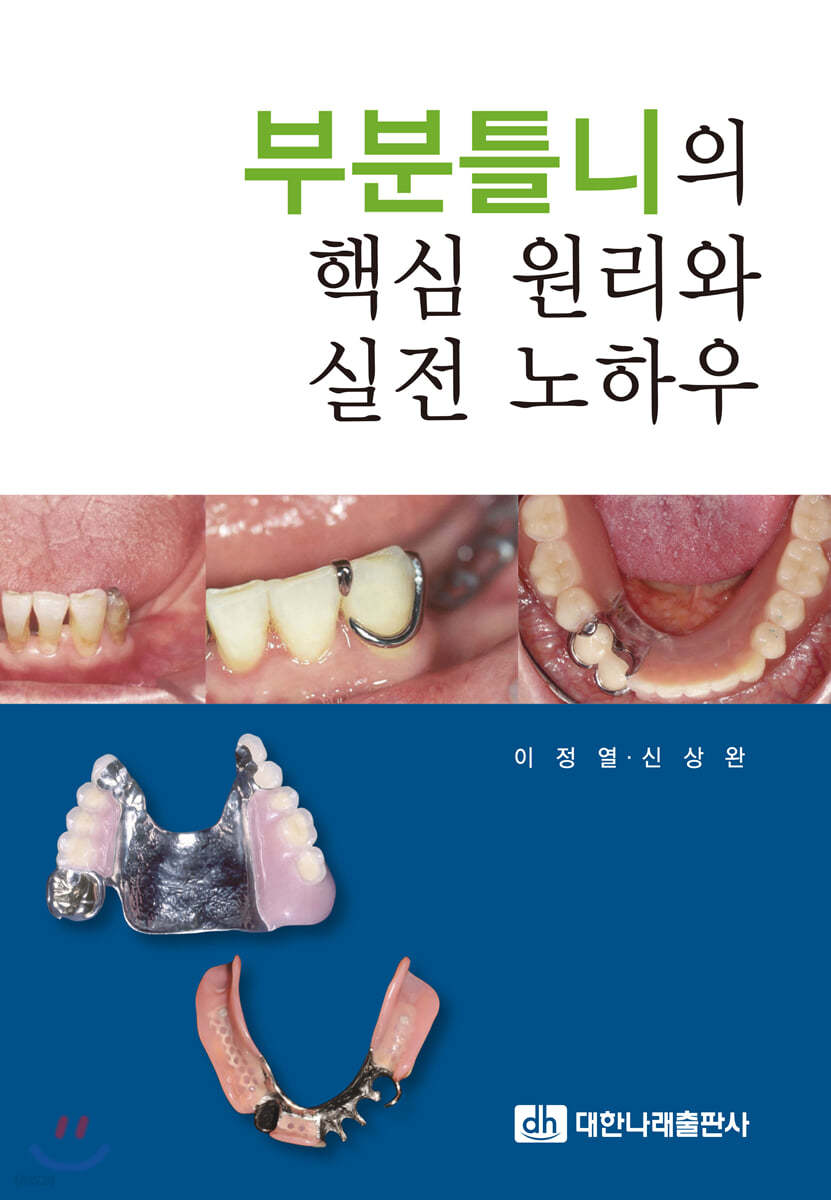 부분틀니의 핵심 원리와 실전 노하우