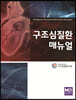 구조심질환 매뉴얼