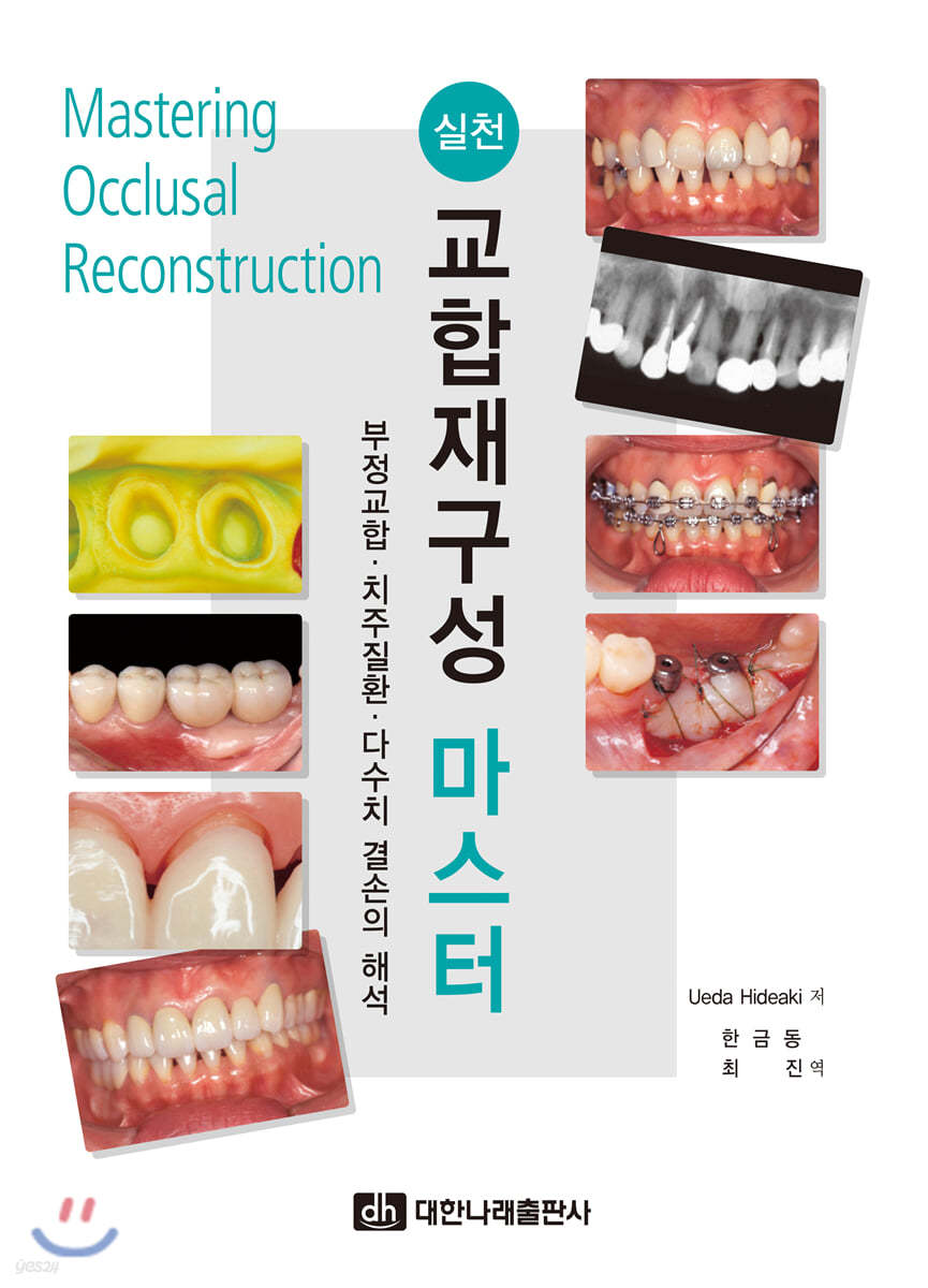 실천 교합재구성 마스터