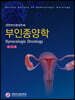부인종양학