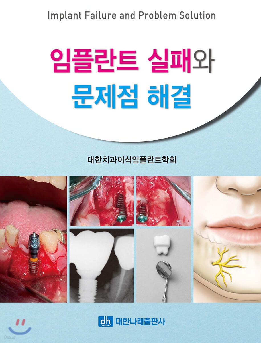 임플란트 실패와 문제점 해결