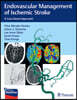 Endovascular Management of Ischemic Stroke: A Case-Based Approach