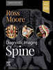 Diagnostic Imaging: Spine