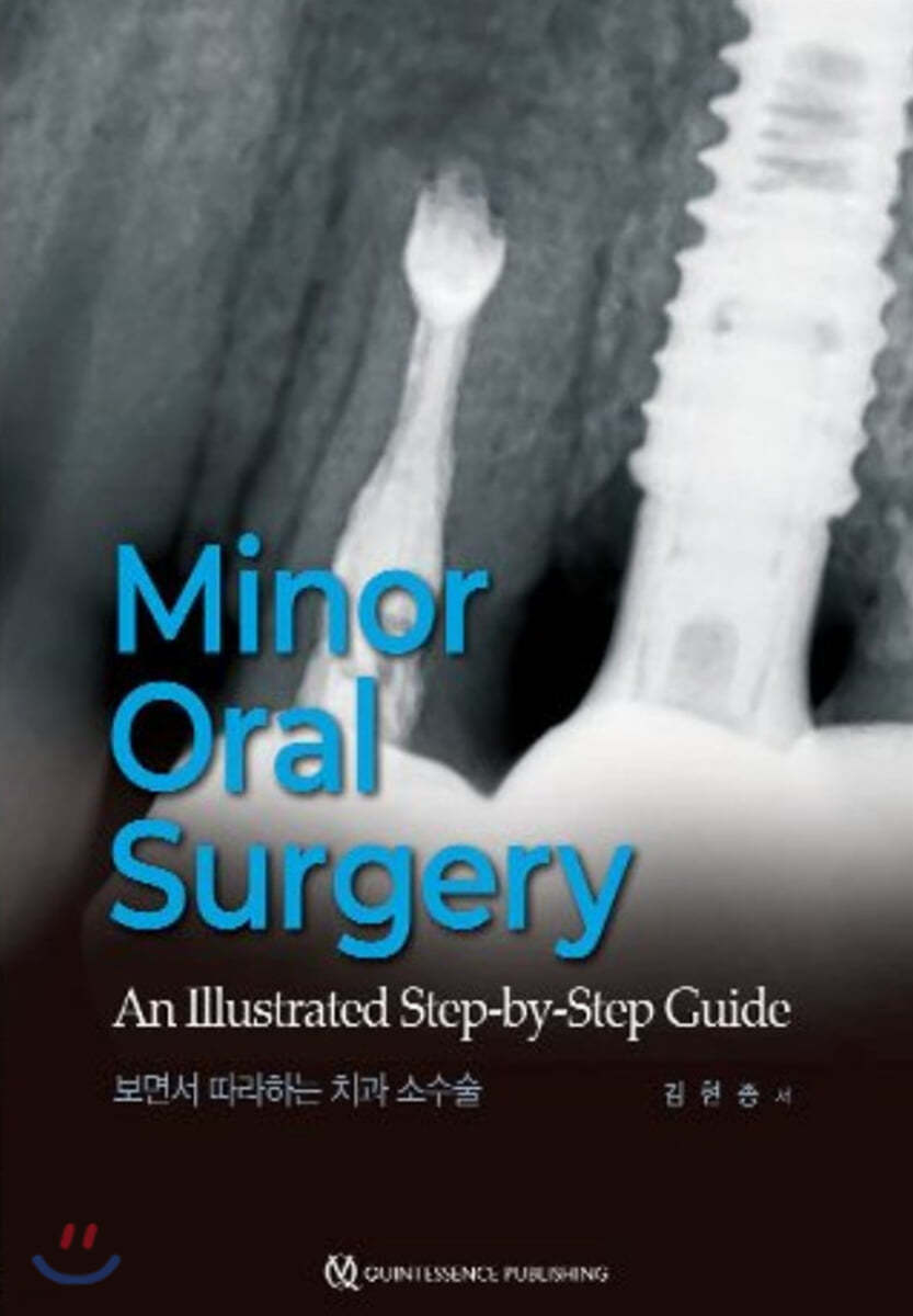 Minor Oral Surgery 보면서 따라하는 치과 소수술