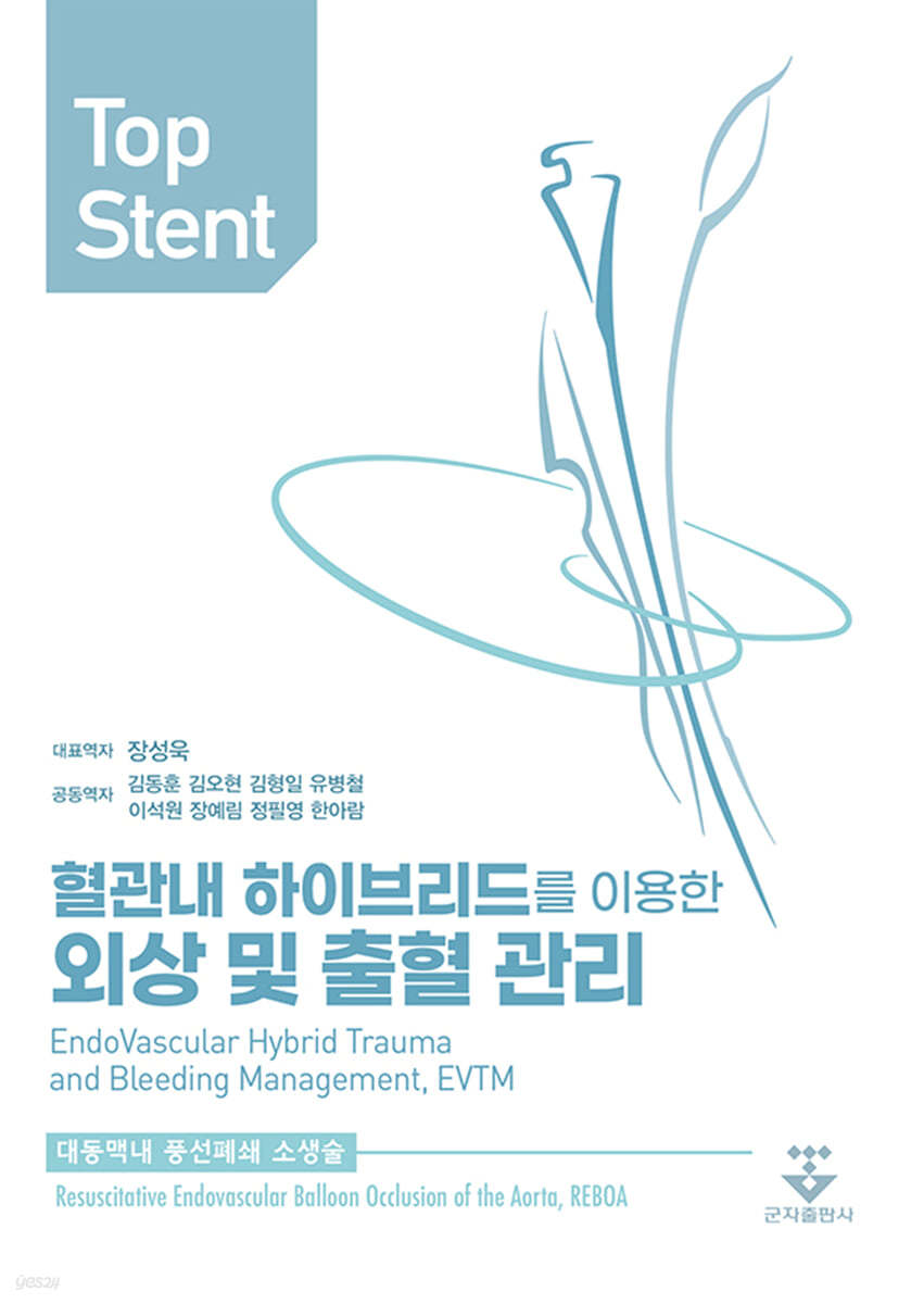 Top Stent 