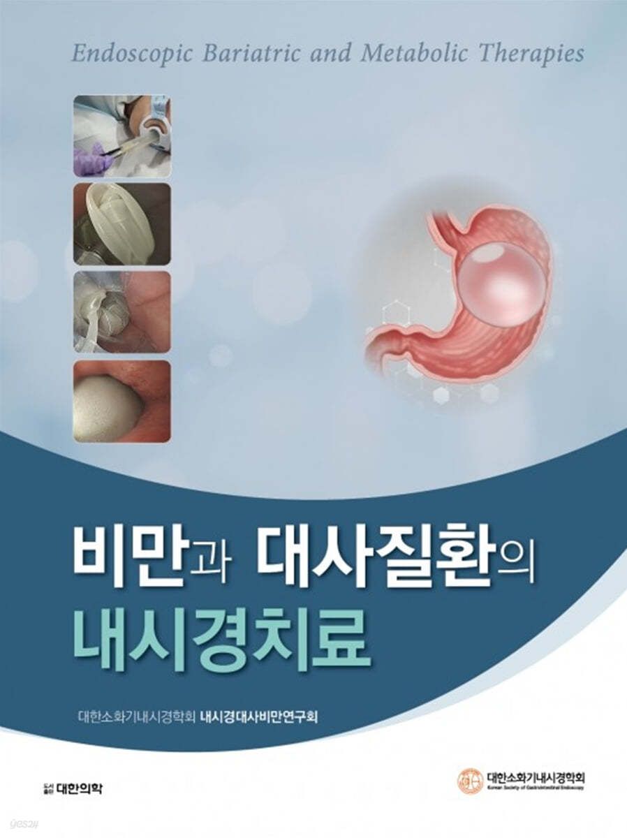 비만과 대사질환의 내시경치료