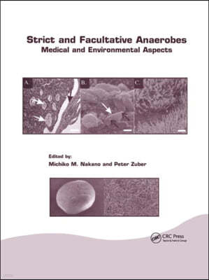 Strict and Facultative Anaerobes