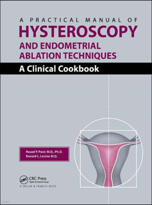 A Practical Manual of Hysteroscopy and Endometrial Ablation Techniques