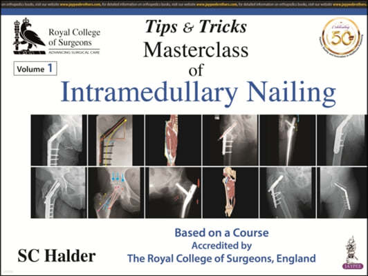 Tips and Tricks: Masterclass of Intramedullary Nailing