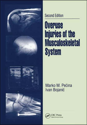 Overuse Injuries of the Musculoskeletal System