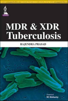 MDR and XDR Tuberculosis