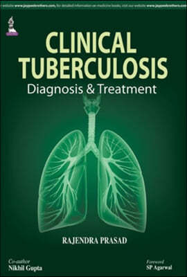 Clinical Tuberculosis