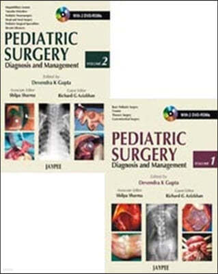 Pediatric Surgery Diagnosis and Management