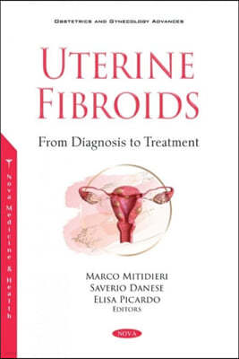 Uterine Fibroids from Diagnosis to Treatment