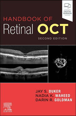 Handbook of Retinal Oct: Optical Coherence Tomography, 2/E