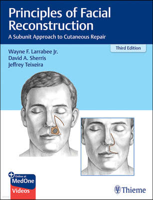 Principles of Facial Reconstruction: A Subunit Approach to Cutaneous Repair