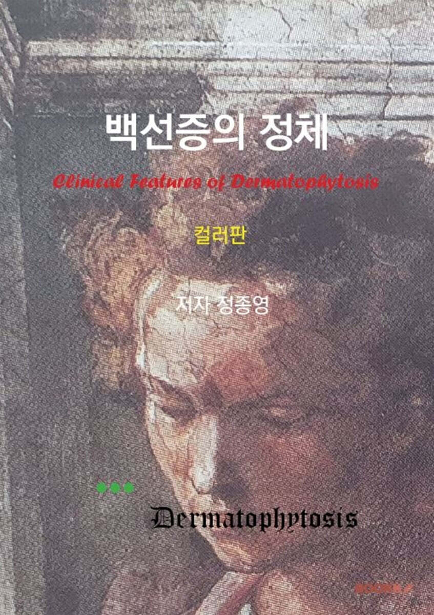 백선증의 정체 (컬러판)