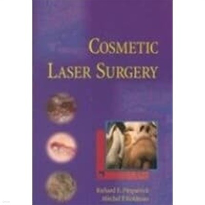 Cosmetic Laser Surgery