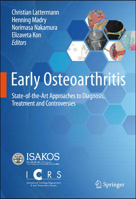 Early Osteoarthritis: State-Of-The-Art Approaches to Diagnosis, Treatment and Controversies