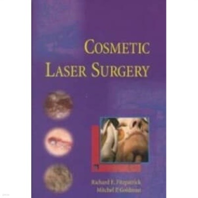 Cosmetic Laser Surgery 