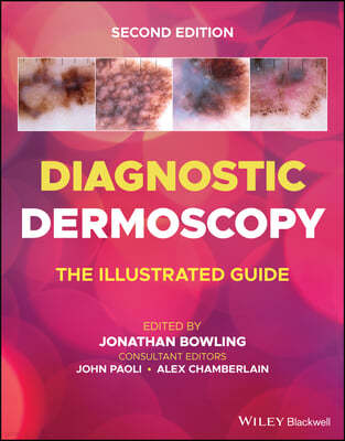 Diagnostic Dermoscopy