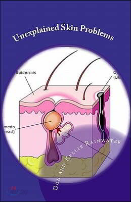 Unexplained Skin Problems: Home Treatment and Precautions