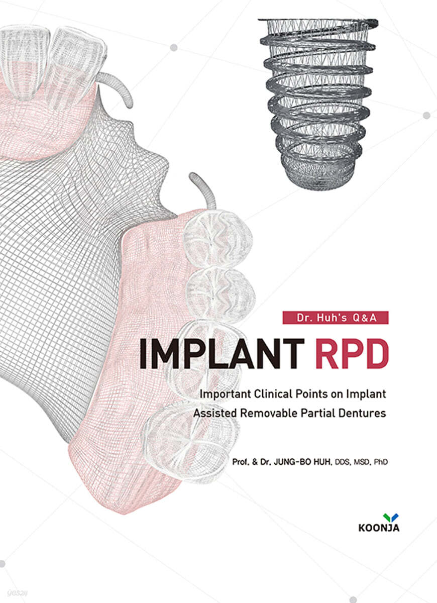 Dr. Huh's Q&A IMPLANT RPD