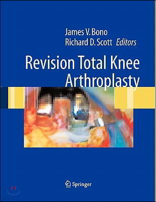 Revision Total Knee Arthroplasty