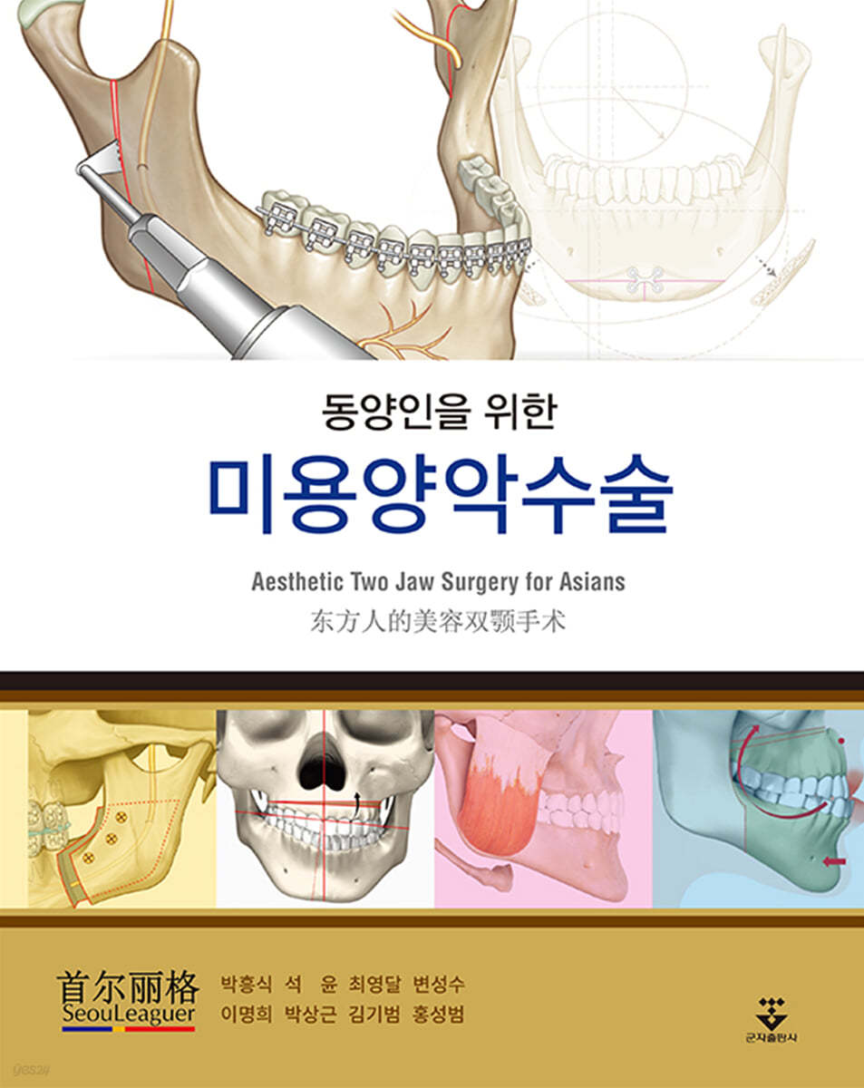 동양인을 위한 미용양악수술