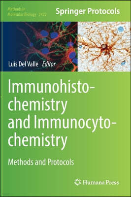 Immunohistochemistry and Immunocytochemistry: Methods and Protocols