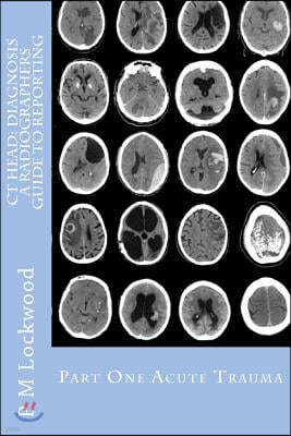 CT Head: Diagnosis a Radiographers Guide to Reporting Part 1 Acute Trauma: Part One Acute Trauma
