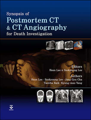 Synopsis of Postmortem CT and CT Angiography for Death Investigation