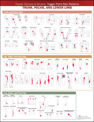 Travell, Simons & Simons' Trigger Point Pain Patterns Wall Chart