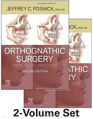 The Orthognathic Surgery - 2 Volume Set