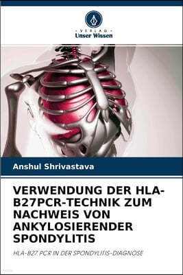 Verwendung Der Hla-B27pcr-Technik Zum Nachweis Von Ankylosierender Spondylitis