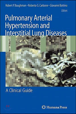 Pulmonary Arterial Hypertension and Interstitial Lung Diseases: A Clinical Guide