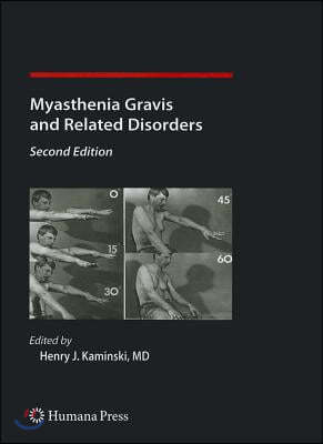 Myasthenia Gravis and Related Disorders